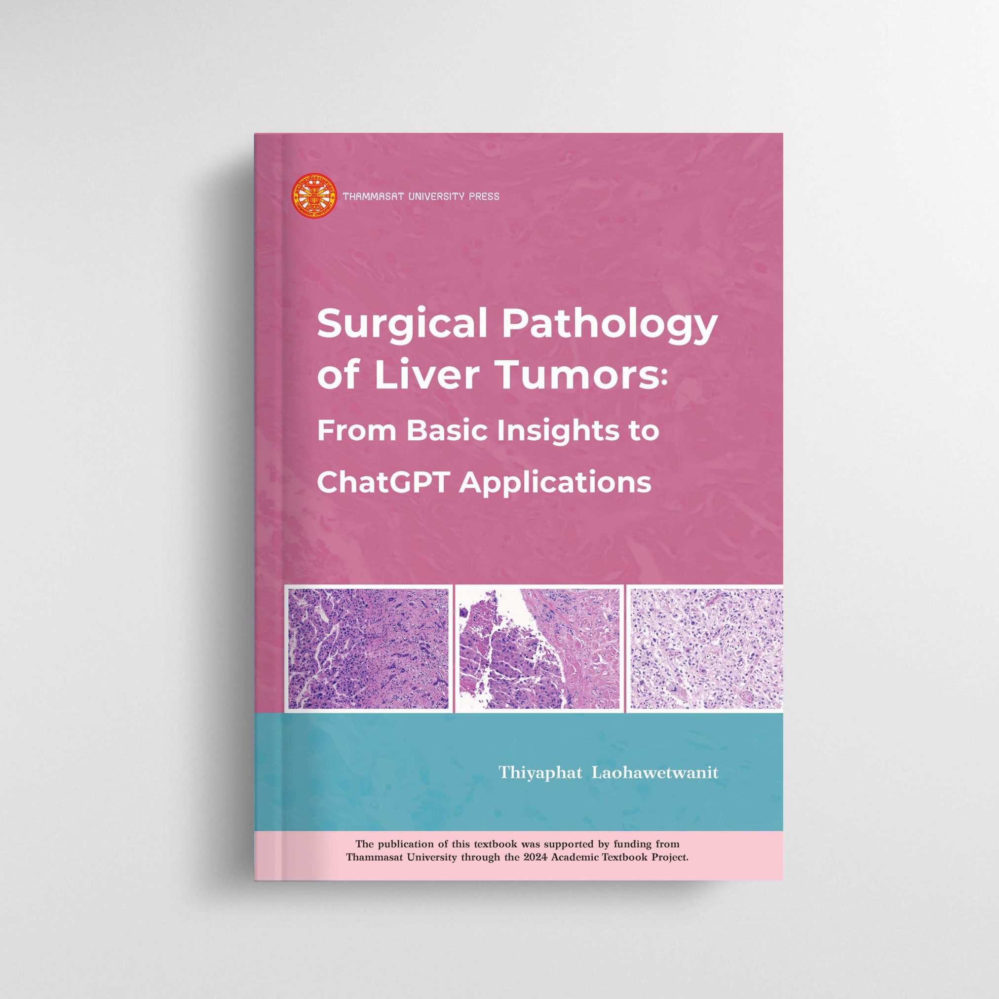 Surgical Pathology of Liver Tumors: From Basic Insights to ChatGPT Applications